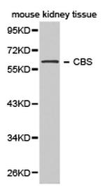 CBS Antibody in Western Blot (WB)