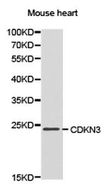 CDKN3 Antibody in Western Blot (WB)