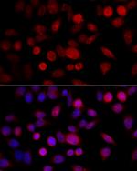 CYP1B1 Antibody in Immunocytochemistry (ICC/IF)