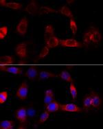 CYP1B1 Antibody in Immunocytochemistry (ICC/IF)