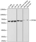 CYP1B1 Antibody in Western Blot (WB)