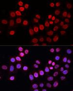 XPG Antibody in Immunocytochemistry (ICC/IF)