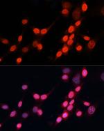 XPG Antibody in Immunocytochemistry (ICC/IF)