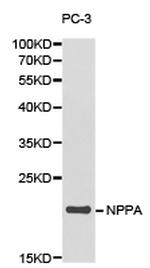 ANP Antibody in Western Blot (WB)