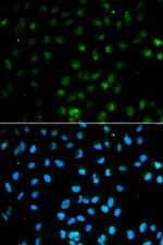 PTPN2 Antibody in Immunocytochemistry (ICC/IF)