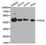 PTPN2 Antibody in Western Blot (WB)