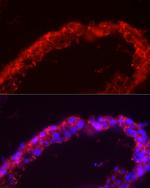 SPAM1 Antibody in Immunocytochemistry (ICC/IF)