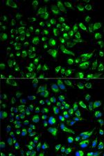 SPAM1 Antibody in Immunocytochemistry (ICC/IF)