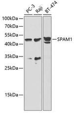 SPAM1 Antibody in Western Blot (WB)