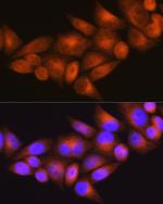 WFS1 Antibody in Immunocytochemistry (ICC/IF)