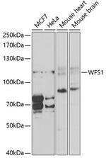 WFS1 Antibody in Western Blot (WB)