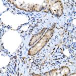 XRCC2 Antibody in Immunohistochemistry (Paraffin) (IHC (P))