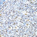 XRCC4 Antibody in Immunohistochemistry (Paraffin) (IHC (P))