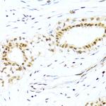 XRCC4 Antibody in Immunohistochemistry (Paraffin) (IHC (P))