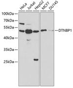 DTNBP1 Antibody in Western Blot (WB)