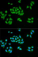 UPF1 Antibody in Immunocytochemistry (ICC/IF)