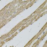 REG3A Antibody in Immunohistochemistry (Paraffin) (IHC (P))