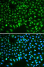 DLG7 Antibody in Immunocytochemistry (ICC/IF)