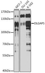 DLG7 Antibody in Western Blot (WB)