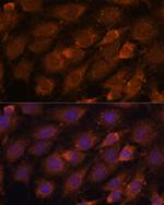 LZIP Antibody in Immunocytochemistry (ICC/IF)