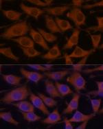 LZIP Antibody in Immunocytochemistry (ICC/IF)