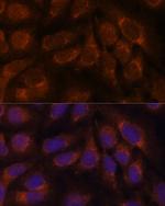 LZIP Antibody in Immunocytochemistry (ICC/IF)