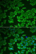 CRHBP Antibody in Immunocytochemistry (ICC/IF)