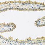 CRHBP Antibody in Immunohistochemistry (Paraffin) (IHC (P))