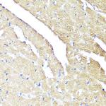 IFNAR2 Antibody in Immunohistochemistry (Paraffin) (IHC (P))