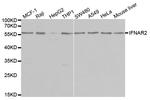 IFNAR2 Antibody in Western Blot (WB)