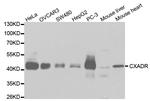 CAR Antibody in Western Blot (WB)