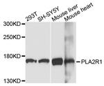 PLA2R1 Antibody in Western Blot (WB)