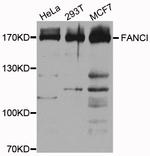 FANCI Antibody in Western Blot (WB)