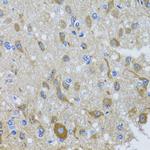 DYNC1I1 Antibody in Immunohistochemistry (Paraffin) (IHC (P))