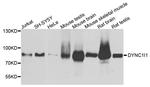 DYNC1I1 Antibody in Western Blot (WB)