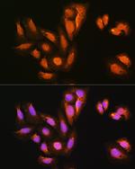 KAP3 Antibody in Immunocytochemistry (ICC/IF)