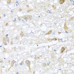 CBR4 Antibody in Immunohistochemistry (Paraffin) (IHC (P))