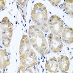 CBR4 Antibody in Immunohistochemistry (Paraffin) (IHC (P))