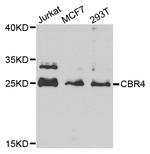 CBR4 Antibody in Western Blot (WB)