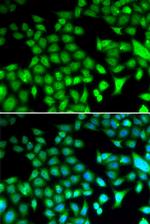 Fra1 Antibody in Immunocytochemistry (ICC/IF)