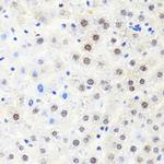 POLR2B Antibody in Immunohistochemistry (Paraffin) (IHC (P))