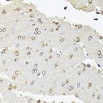 POLR2B Antibody in Immunohistochemistry (Paraffin) (IHC (P))