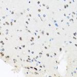 PRP8 Antibody in Immunohistochemistry (Paraffin) (IHC (P))