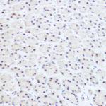 PRP8 Antibody in Immunohistochemistry (Paraffin) (IHC (P))