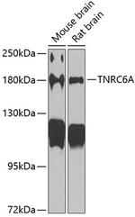 TNRC6A Antibody in Western Blot (WB)