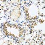 C8orf4 Antibody in Immunohistochemistry (Paraffin) (IHC (P))