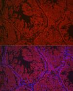 LHR Antibody in Immunocytochemistry (ICC/IF)