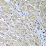 WDR48 Antibody in Immunohistochemistry (Paraffin) (IHC (P))