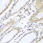 WDR48 Antibody in Immunohistochemistry (Paraffin) (IHC (P))