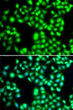 YTHDC1 Antibody in Immunocytochemistry (ICC/IF)